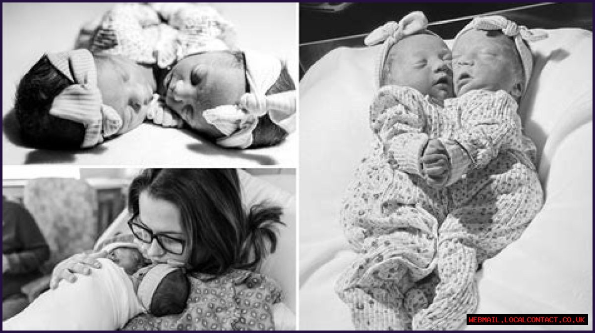 **The Inspiring Journey Of Matthew And Breana Dell: Conjoined Twins**