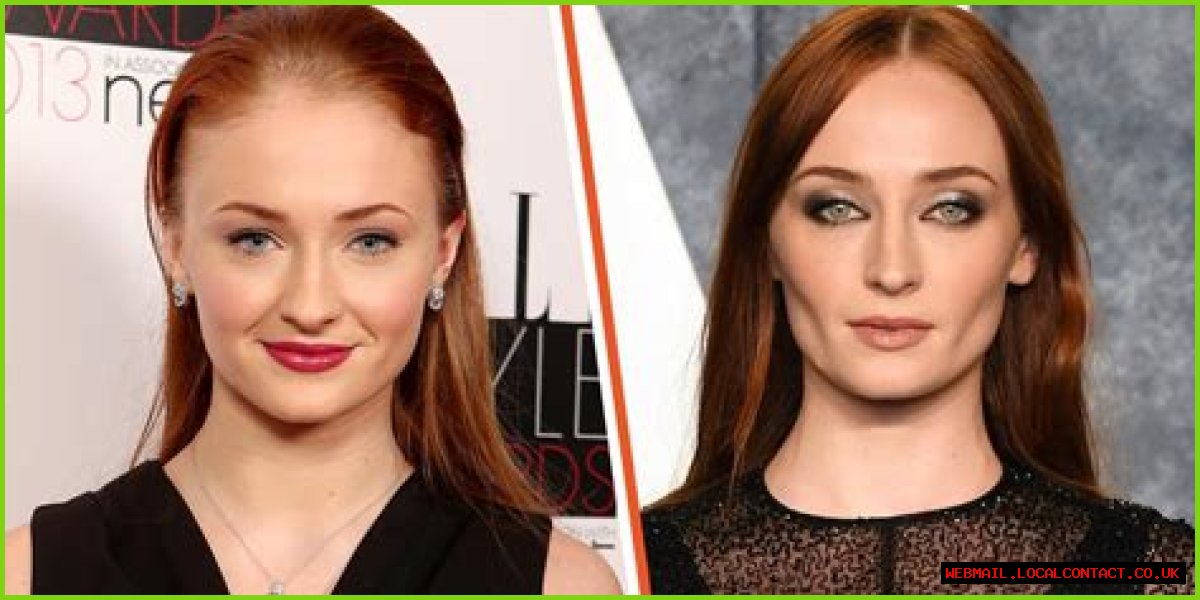 Unveiling The Transformation: Sophie Turner And Buccal Fat Removal