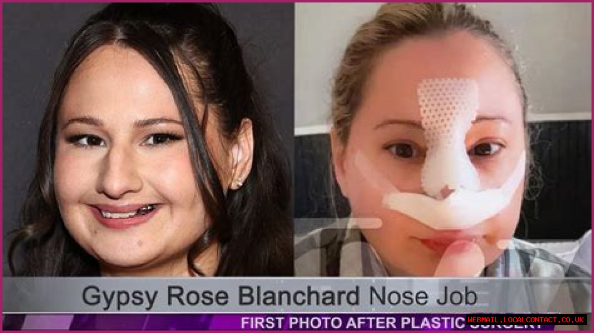 Unveiling The Transformation: The Nose Job Of Gypsy Rose